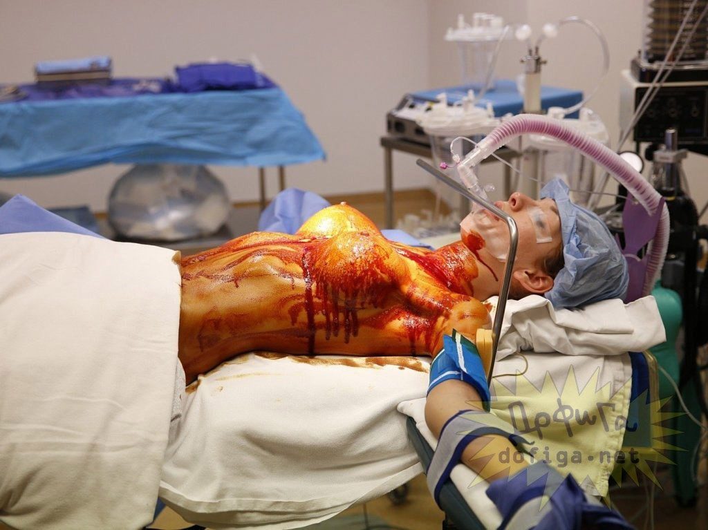 【※不謹慎】豊胸手術で意識の無い患者の「新おっぱい」をSNSに上げるアホ医者ヤバすぎワロタｗｗｗｗｗｗｗｗｗｗｗｗｗｗ(画像あり)・2枚目
